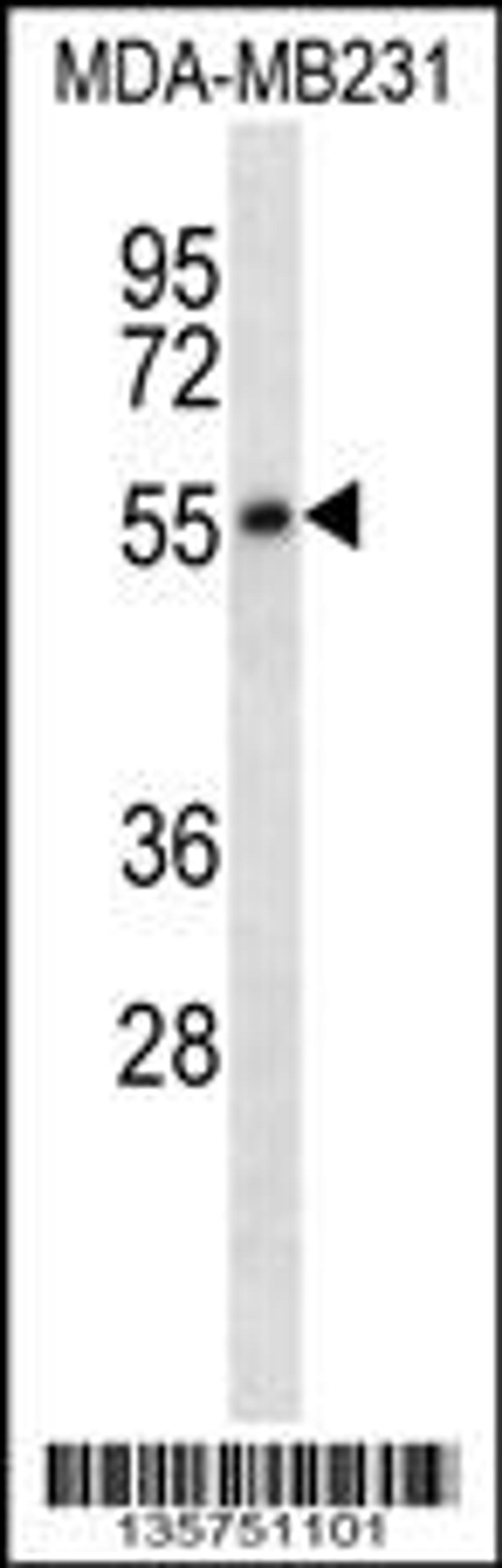 Western blot analysis in MDA-MB231 cell line lysates (35ug/lane).