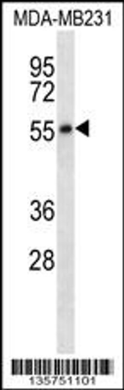 Western blot analysis in MDA-MB231 cell line lysates (35ug/lane).