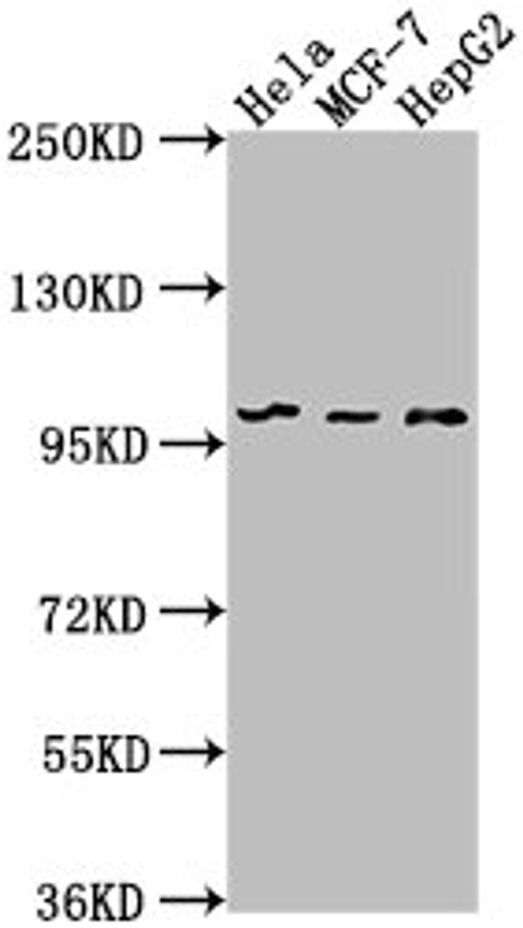 Western Blot. Positive WB detected in: Hela whole cell lysate, MCF-7 whole cell lysate, HepG2 whole cell lysate. All lanes: EIF4G2 antibody at 1:1000. Secondary. Goat polyclonal to rabbit IgG at 1/50000 dilution. Predicted band size: 103, 99 kDa. Observed band size: 99 kDa.