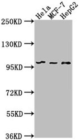 Western Blot. Positive WB detected in: Hela whole cell lysate, MCF-7 whole cell lysate, HepG2 whole cell lysate. All lanes: EIF4G2 antibody at 1:1000. Secondary. Goat polyclonal to rabbit IgG at 1/50000 dilution. Predicted band size: 103, 99 kDa. Observed band size: 99 kDa.