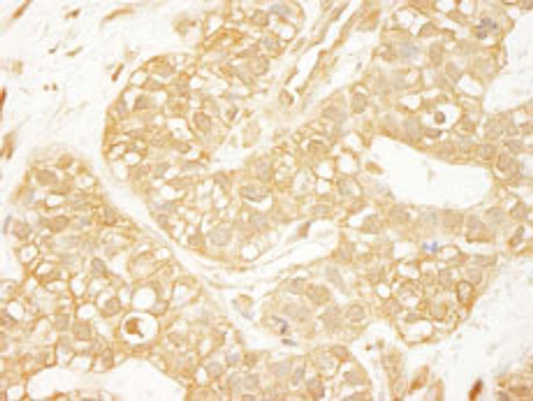 Detection of human PDZ-RhoGEF by immunohistochemistry.