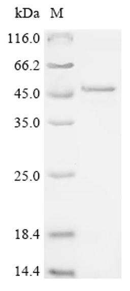 (Tris-Glycine gel) Discontinuous SDS-PAGE (reduced) with 5% enrichment gel and 15% separation gel.