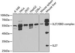 Western blot - IL27 antibody (A5498)