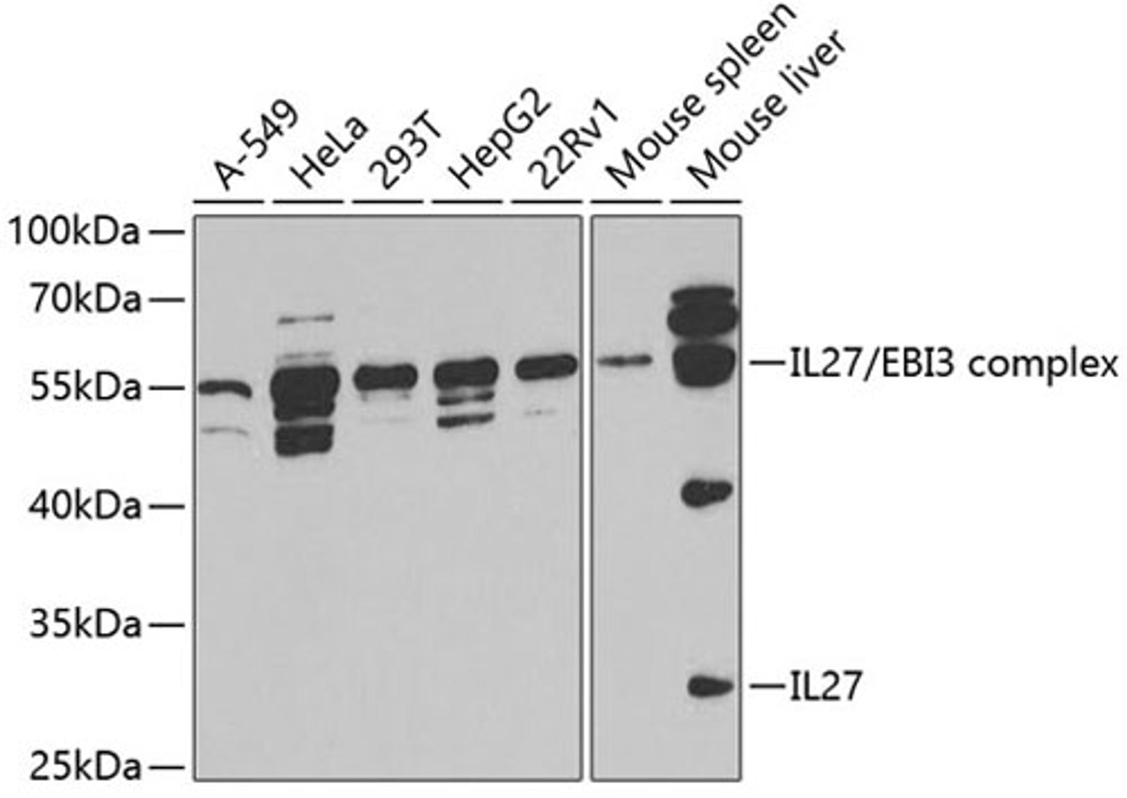 Western blot - IL27 antibody (A5498)