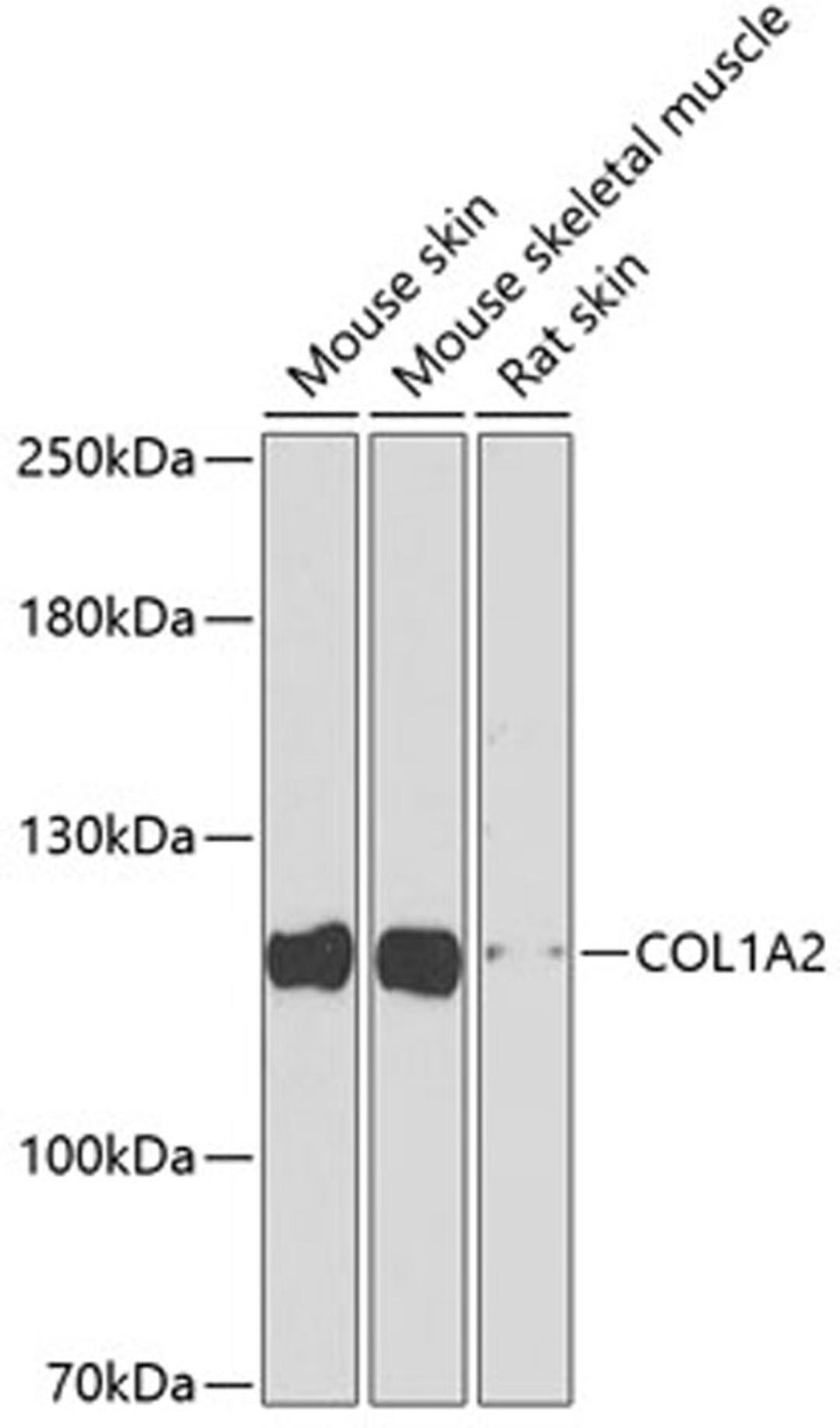 Western blot - COL1A2 antibody (A5786)