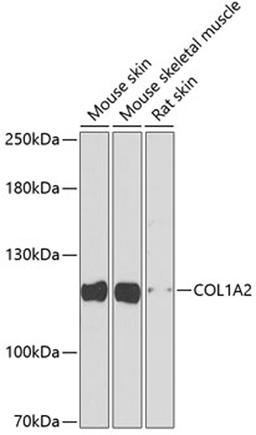 Western blot - COL1A2 antibody (A5786)