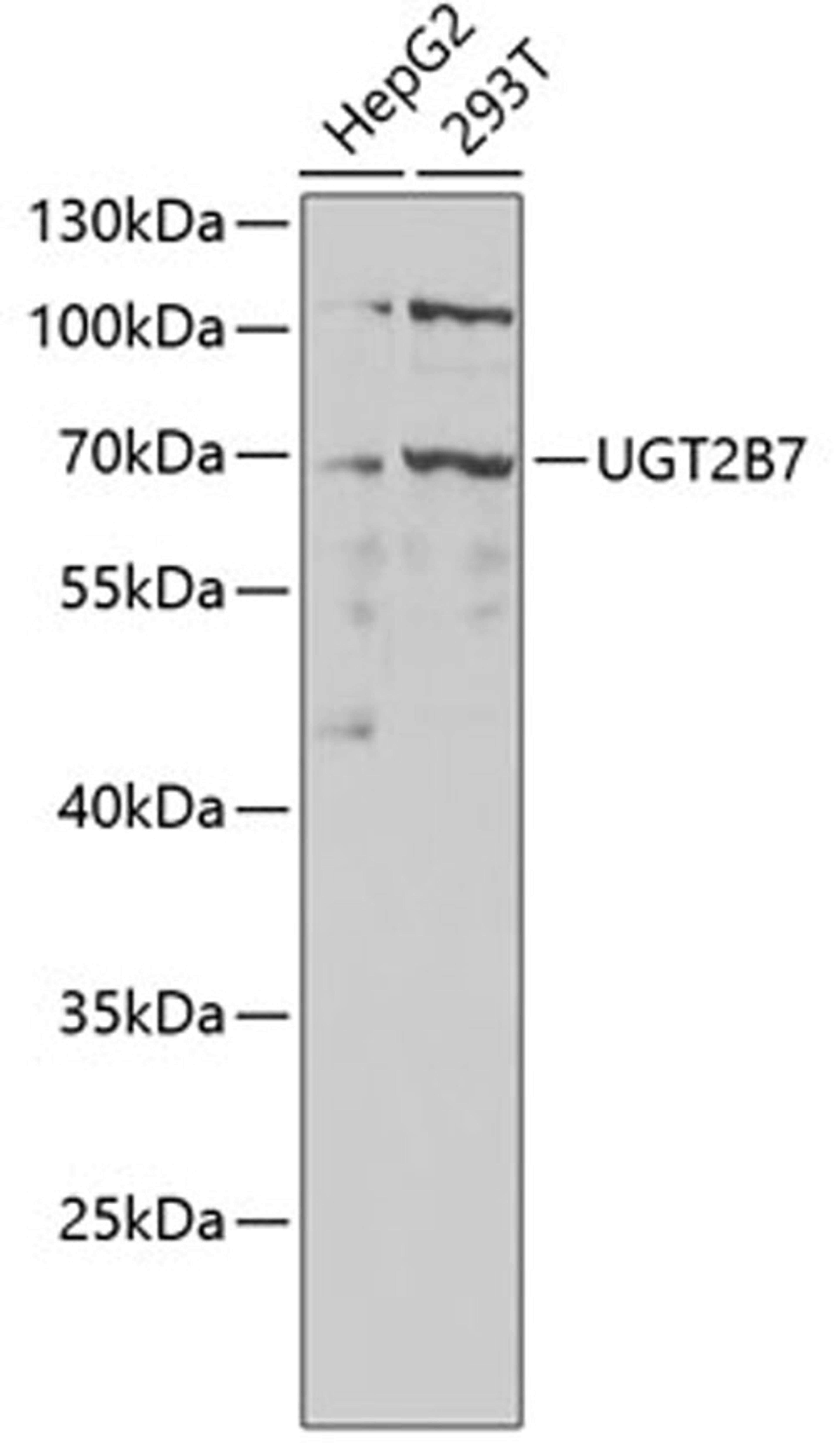 Western blot - UGT2B7 antibody (A1693)