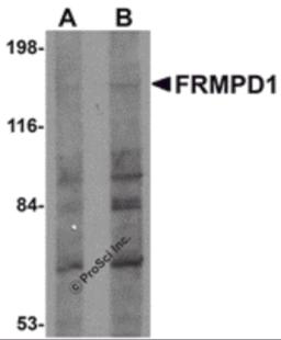 Western blot analysis of FRMPD1 in K562 cell lysate with FRMPD1 antibody at (A) 1 and (B) 2 &#956;g/mL.