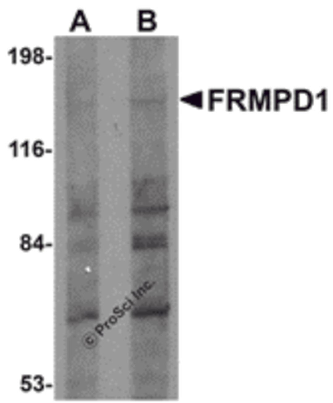 Western blot analysis of FRMPD1 in K562 cell lysate with FRMPD1 antibody at (A) 1 and (B) 2 μg/mL.