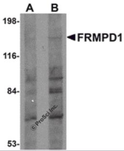 Western blot analysis of FRMPD1 in K562 cell lysate with FRMPD1 antibody at (A) 1 and (B) 2 μg/mL.