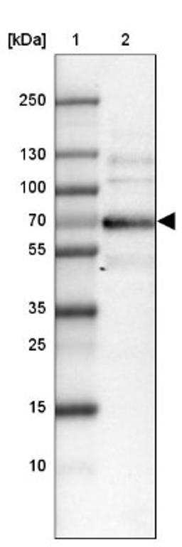 Western Blot: SORBS1 Antibody [NBP1-86641] - Lane 1: Marker [kDa] 250, 130, 100, 70, 55, 35, 25, 15, 10<br/>Lane 2: Tonsil