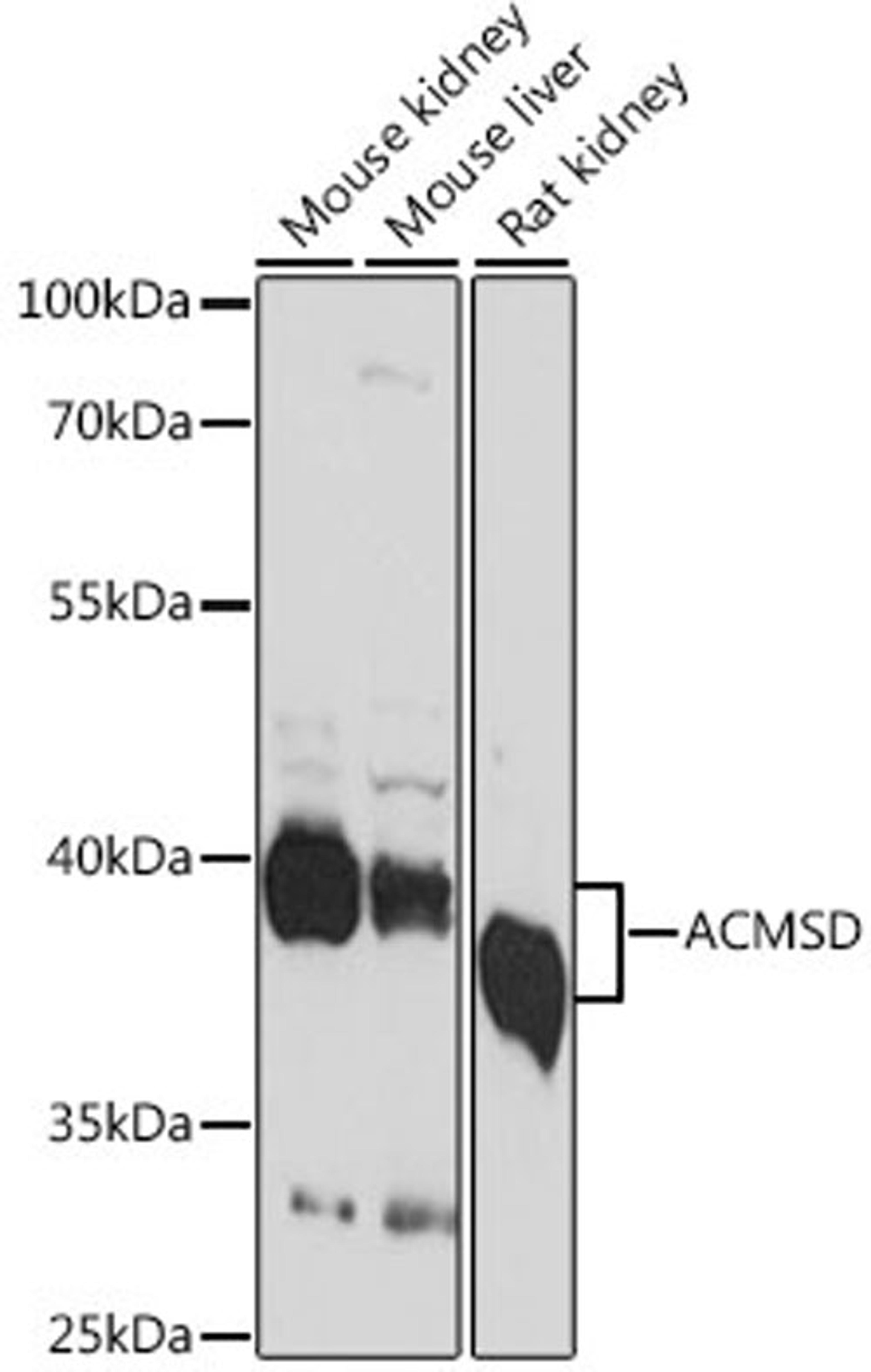 Western blot - ACMSD antibody (A15953)