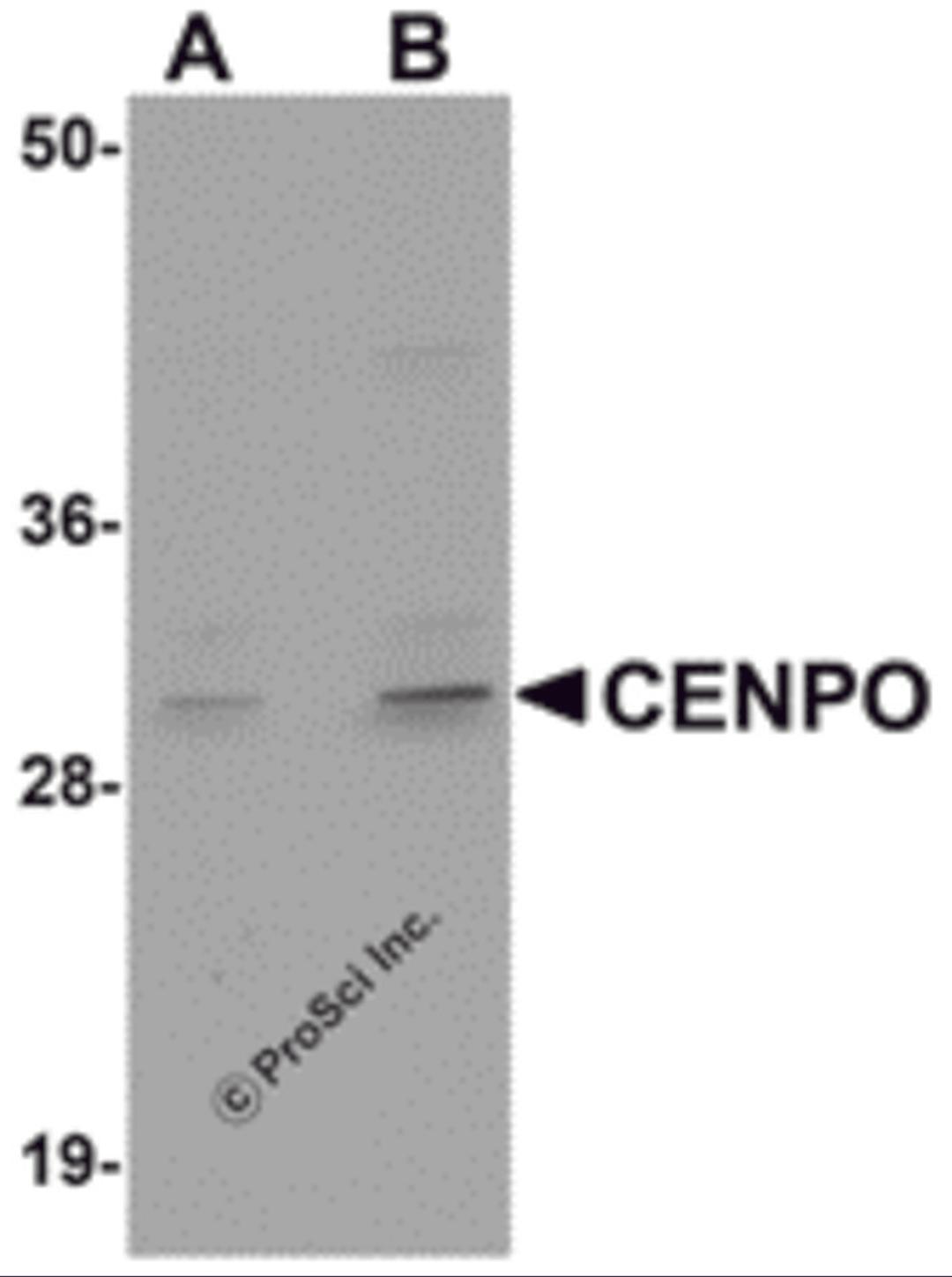 Western blot analysis of CENPO in mouse kidney tissue lysate with CENPO antibody at (A) 1 and (B) 2 μg/mL.