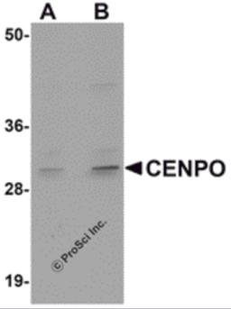 Western blot analysis of CENPO in mouse kidney tissue lysate with CENPO antibody at (A) 1 and (B) 2 μg/mL.