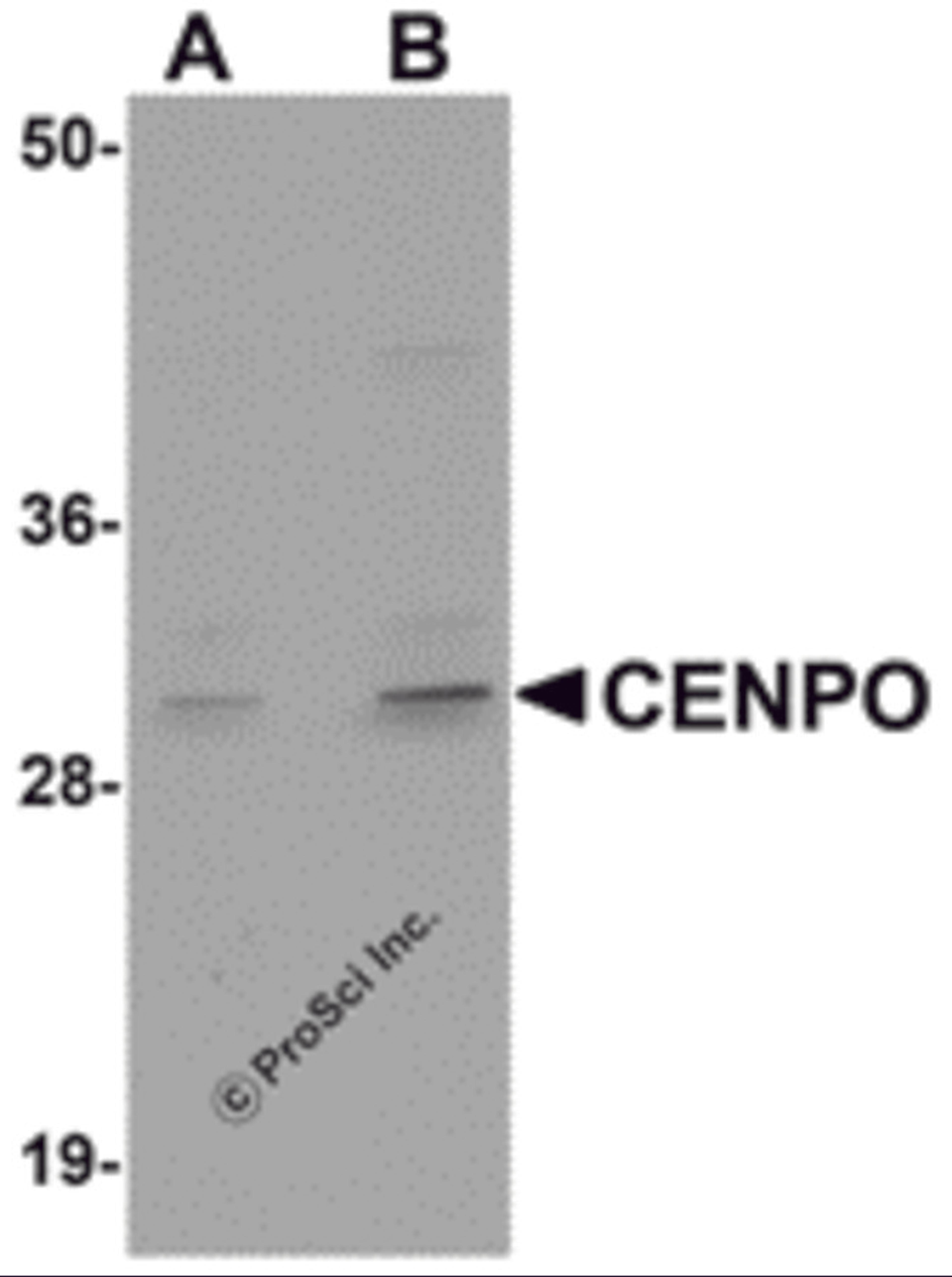 Western blot analysis of CENPO in mouse kidney tissue lysate with CENPO antibody at (A) 1 and (B) 2 μg/mL.