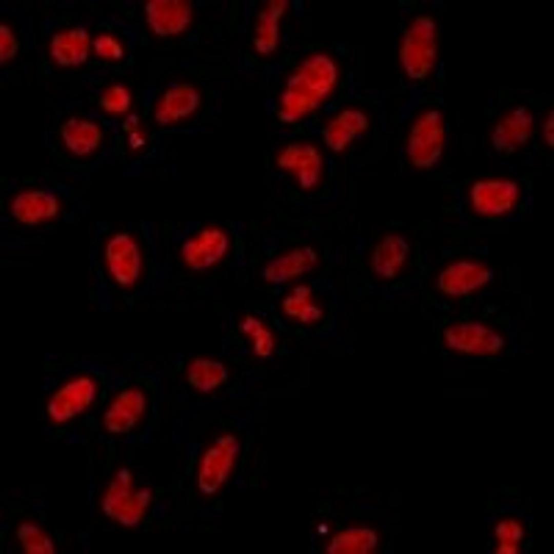 Immunofluorescent analysis of HeLa cells using POLR2F antibody