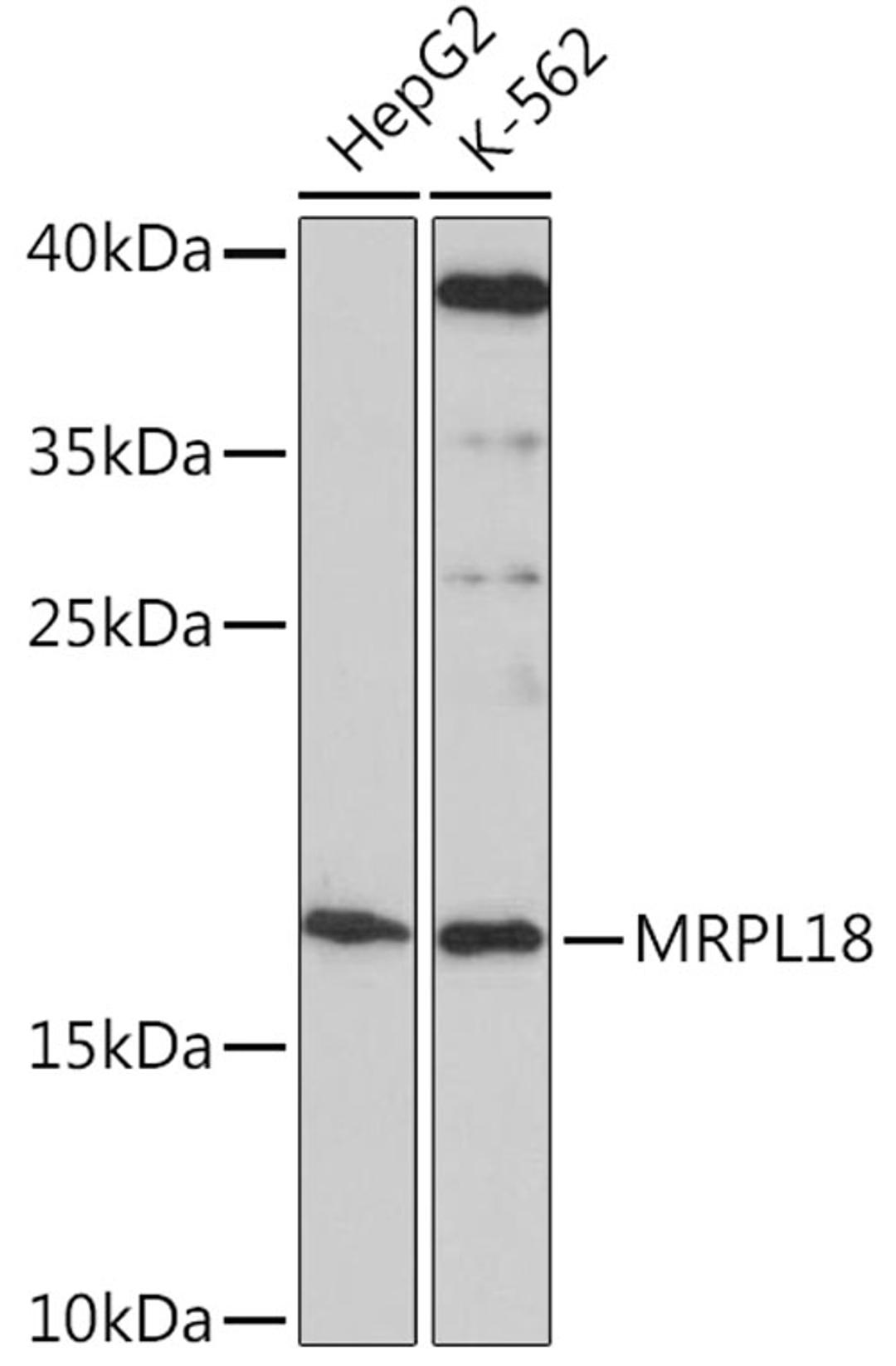 Western blot - MRPL18 Rabbit pAb (A16231)