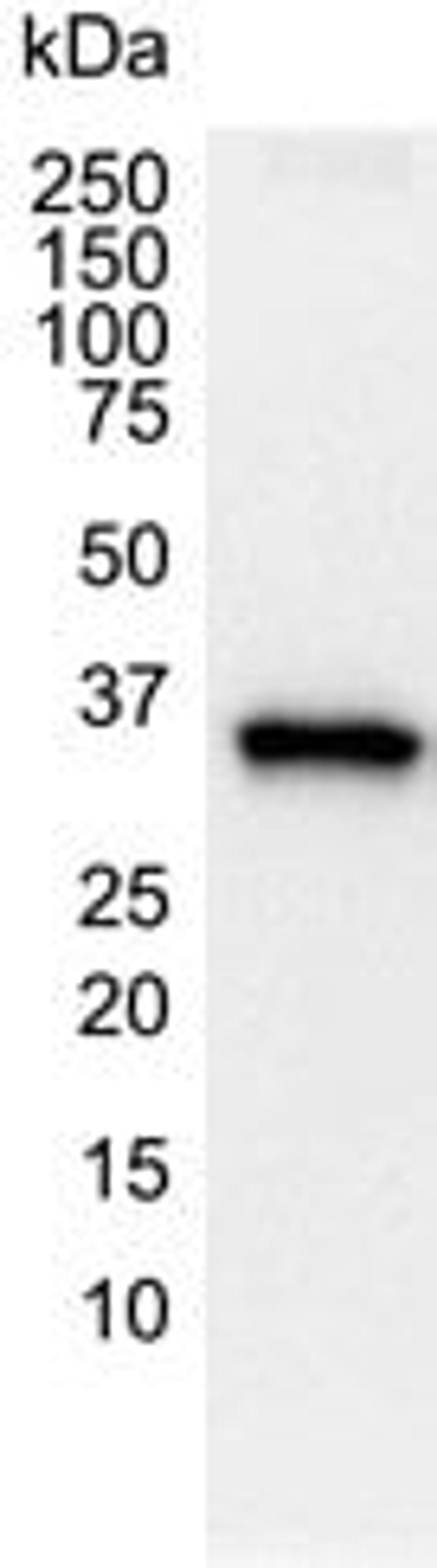 Western blot analysis of HepG2 human hepatic carcinoma whole cell lysate