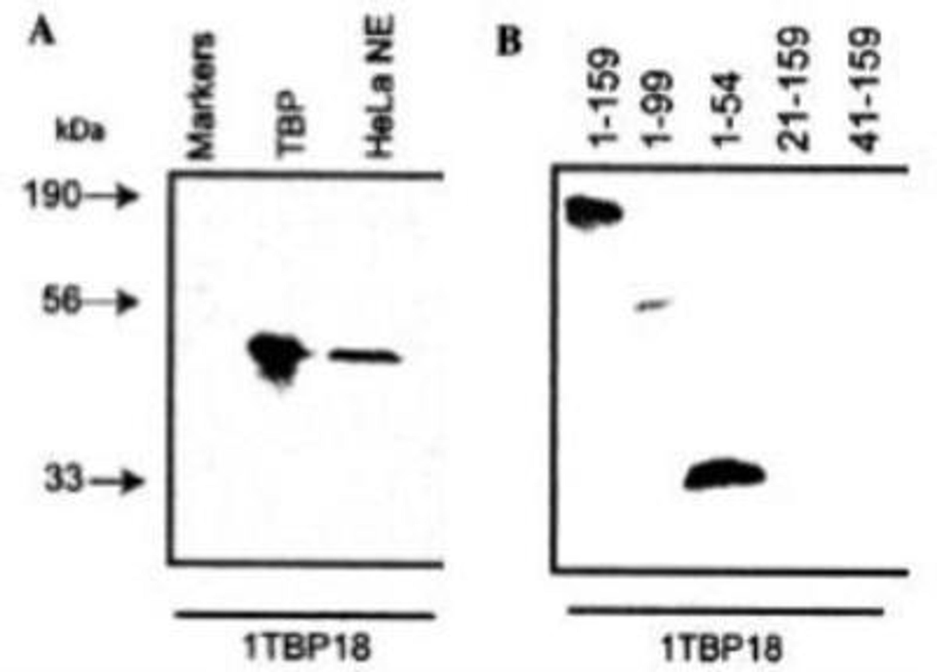 Western Blot: TATA binding protein TBP Antibody (1TBP18) [NB500-700] - A. Reactivity with rhuTBP and HeLa cell nuclear extract with NB500-700 at 2ug/ml. B. Epitope mapping by immunoblot with fragments of rhuTBP with NB500-700 at 2ug/ml.