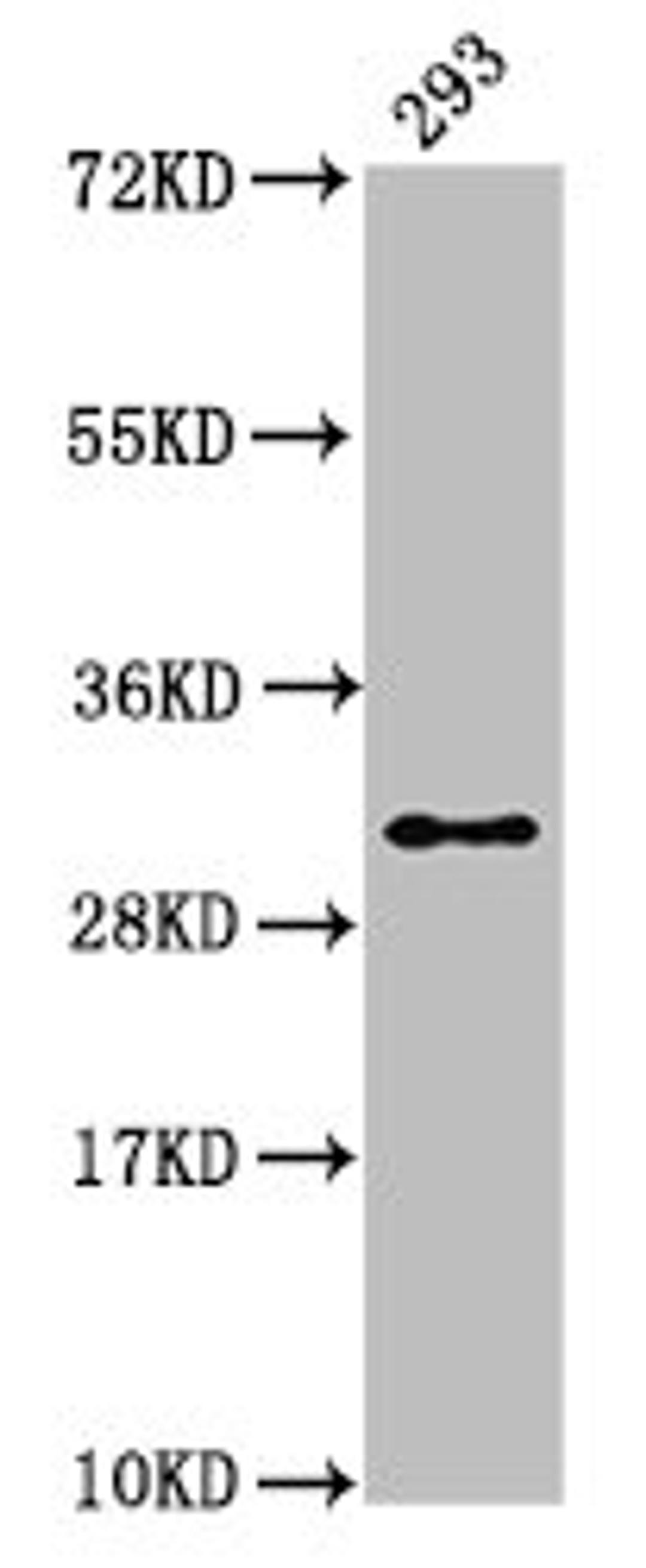 Western Blot. Positive WB detected in: 293 whole cell lysate. All lanes: HIST1H2AG antibody at 1.34µg/ml. Secondary. Goat polyclonal to rabbit IgG at 1/50000 dilution. Predicted band size: 15 kDa. Observed band size: 32 kDa