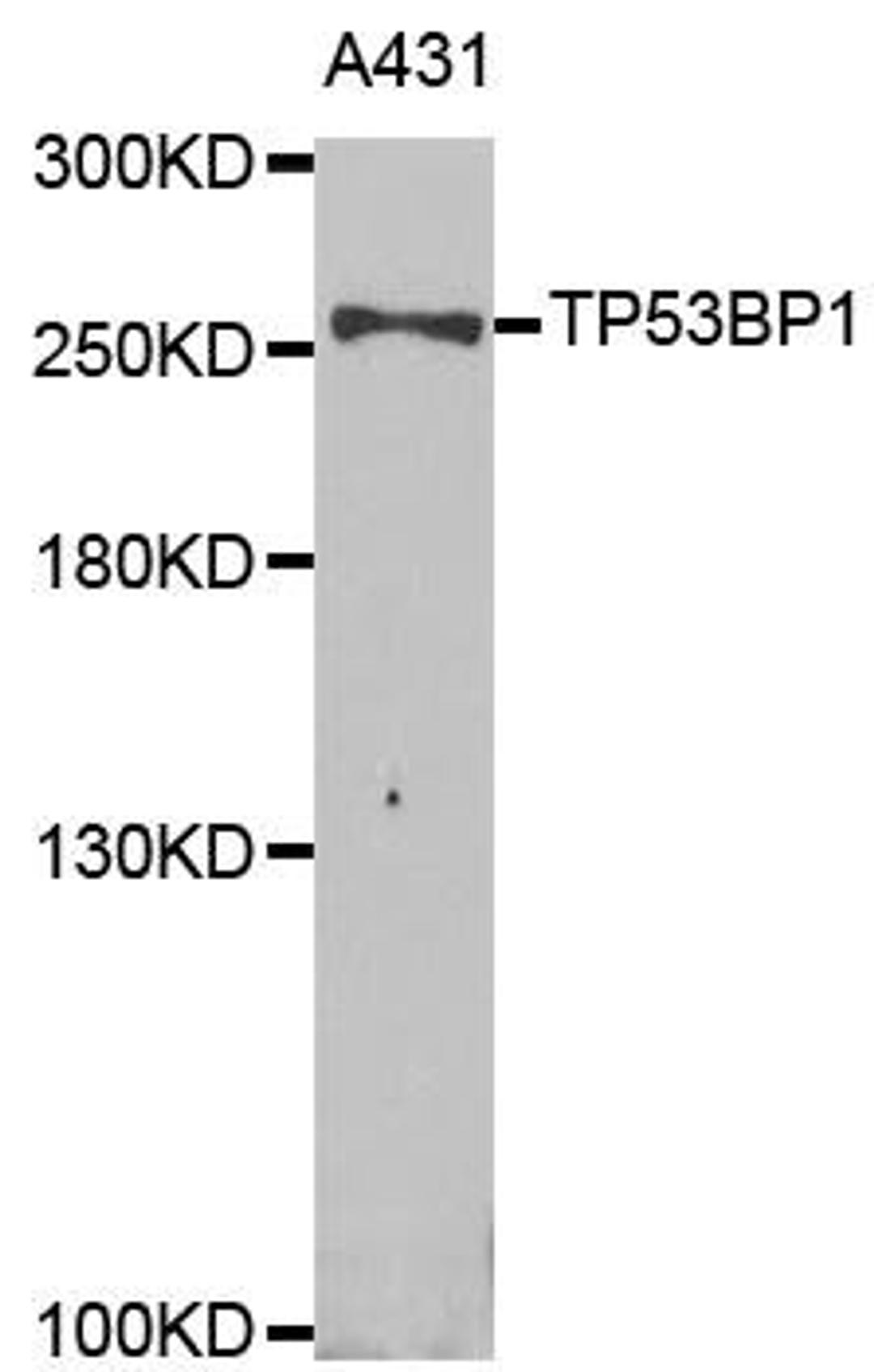 Western blot analysis of extracts of A431 cell line using TP53BP1 antibody