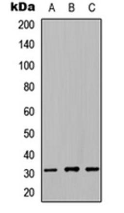 Western blot analysis of HEK293T (Lane1), NS-1 (Lane2), H9C2 (Lane3) whole cell using NRIP2 antibody