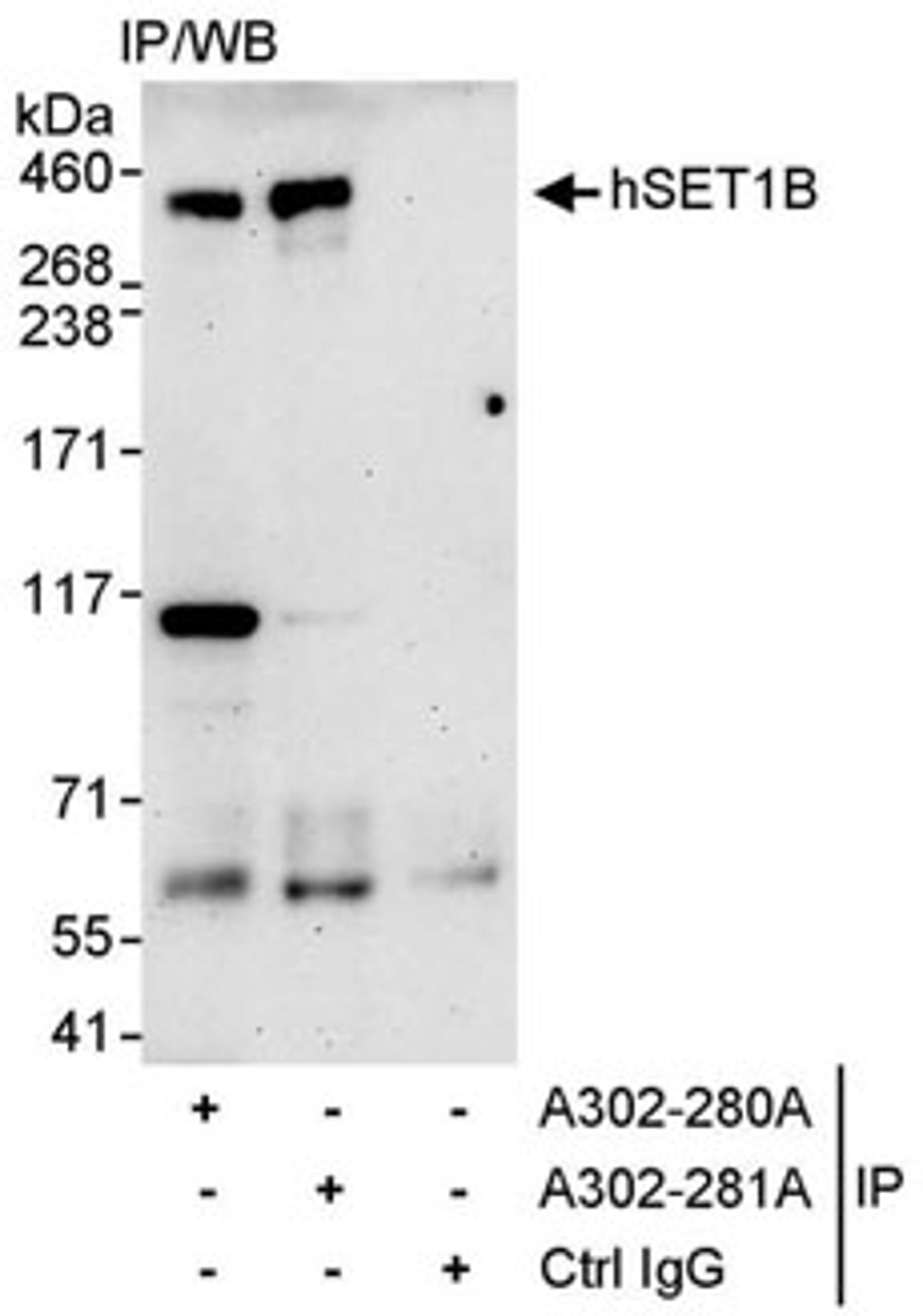 Detection of human hSET1B by western blot of immunoprecipitates.