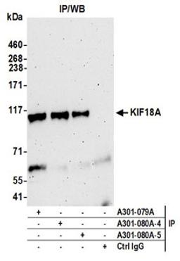 Detection of human KIF18A by western blot of immunoprecipitates.