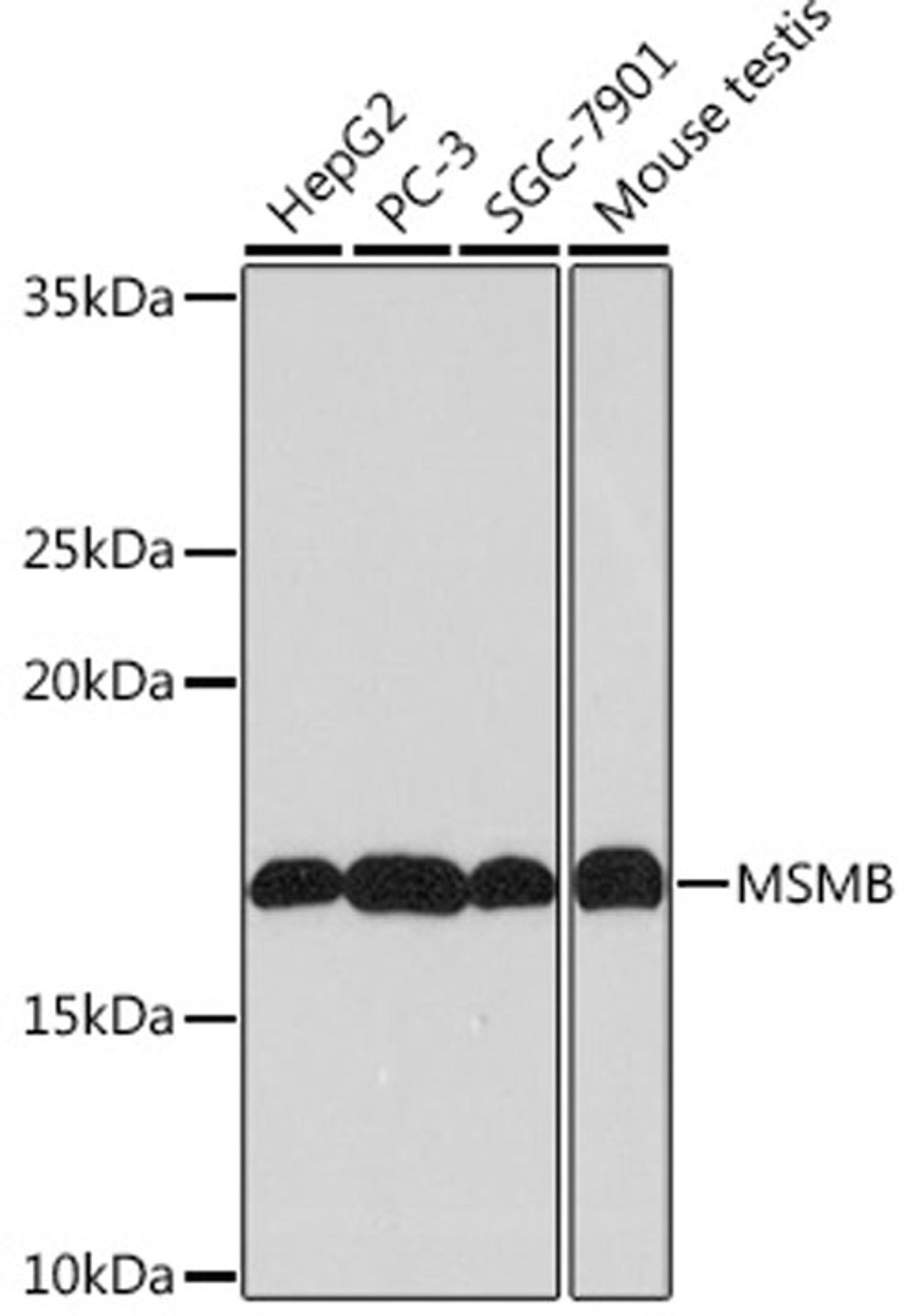 Western blot - MSMB Rabbit mAb (A4168)