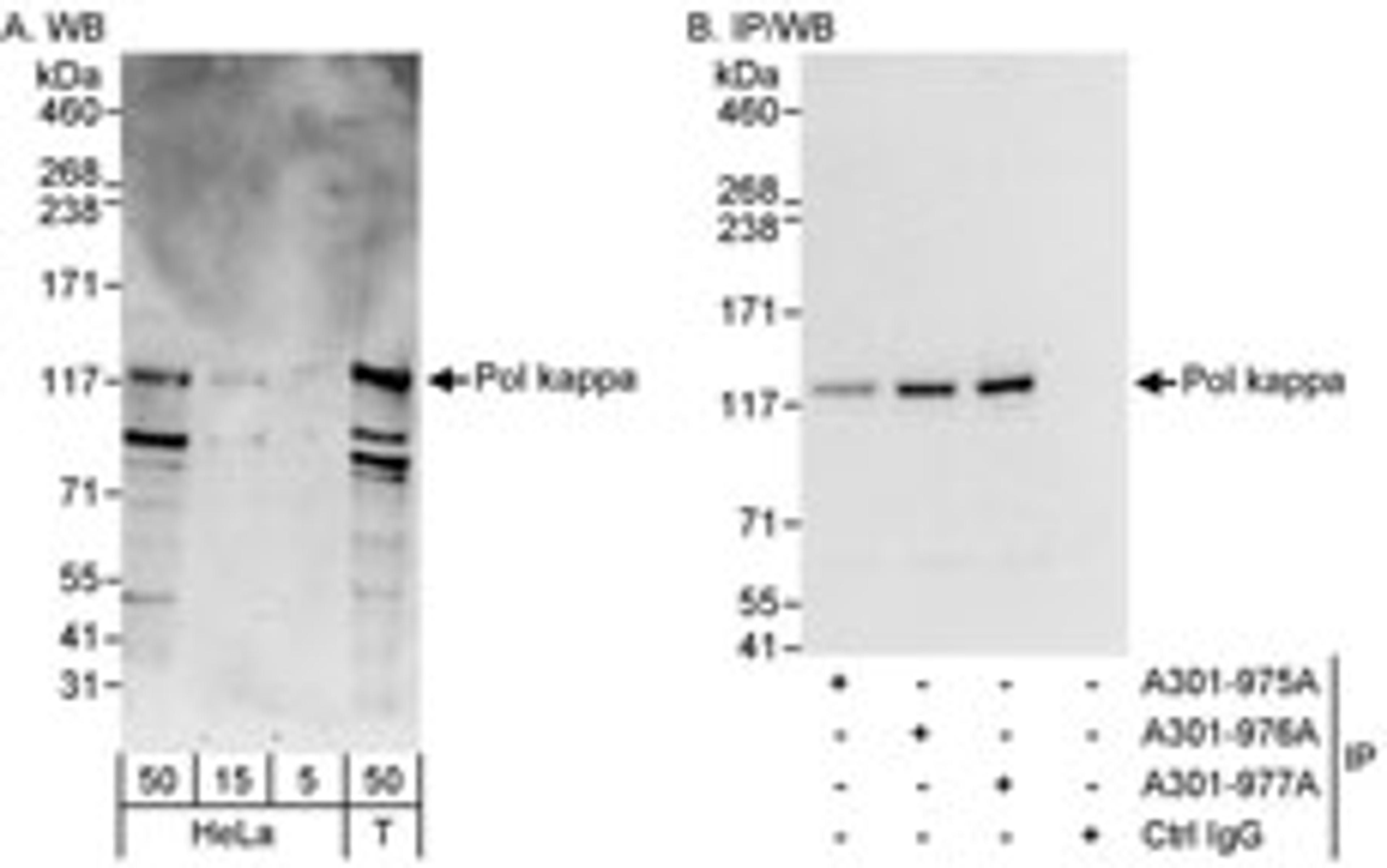 Detection of human Pol kappa by western blot and immunoprecipitation.