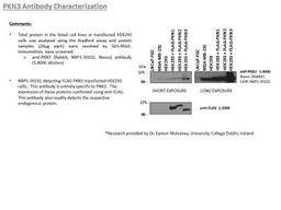 Western Blot: PKN3 Antibody [NBP1-30102] - Image from verified customer review.