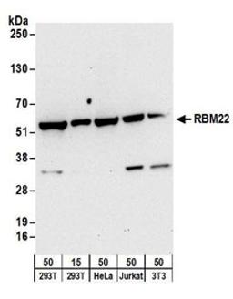 Detection of human and mouse RBM22 by western blot.