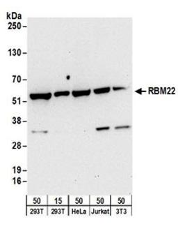 Detection of human and mouse RBM22 by western blot.