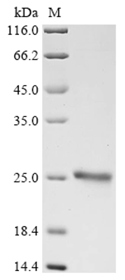 (Tris-Glycine gel) Discontinuous SDS-PAGE (reduced) with 5% enrichment gel and 15% separation gel.