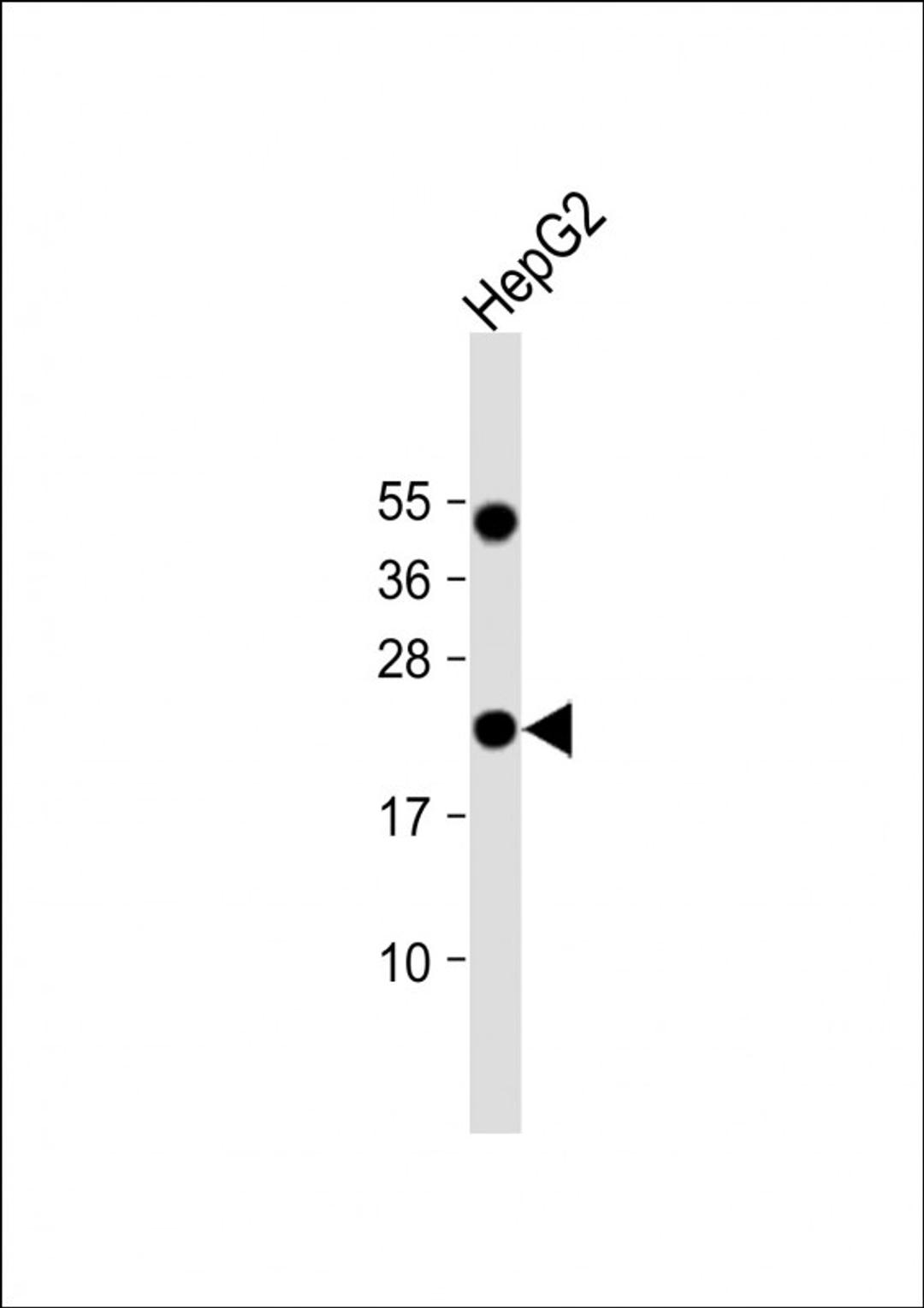 Western Blot at 1:1000 dilution + HepG2 whole cell lysate Lysates/proteins at 20 ug per lane.