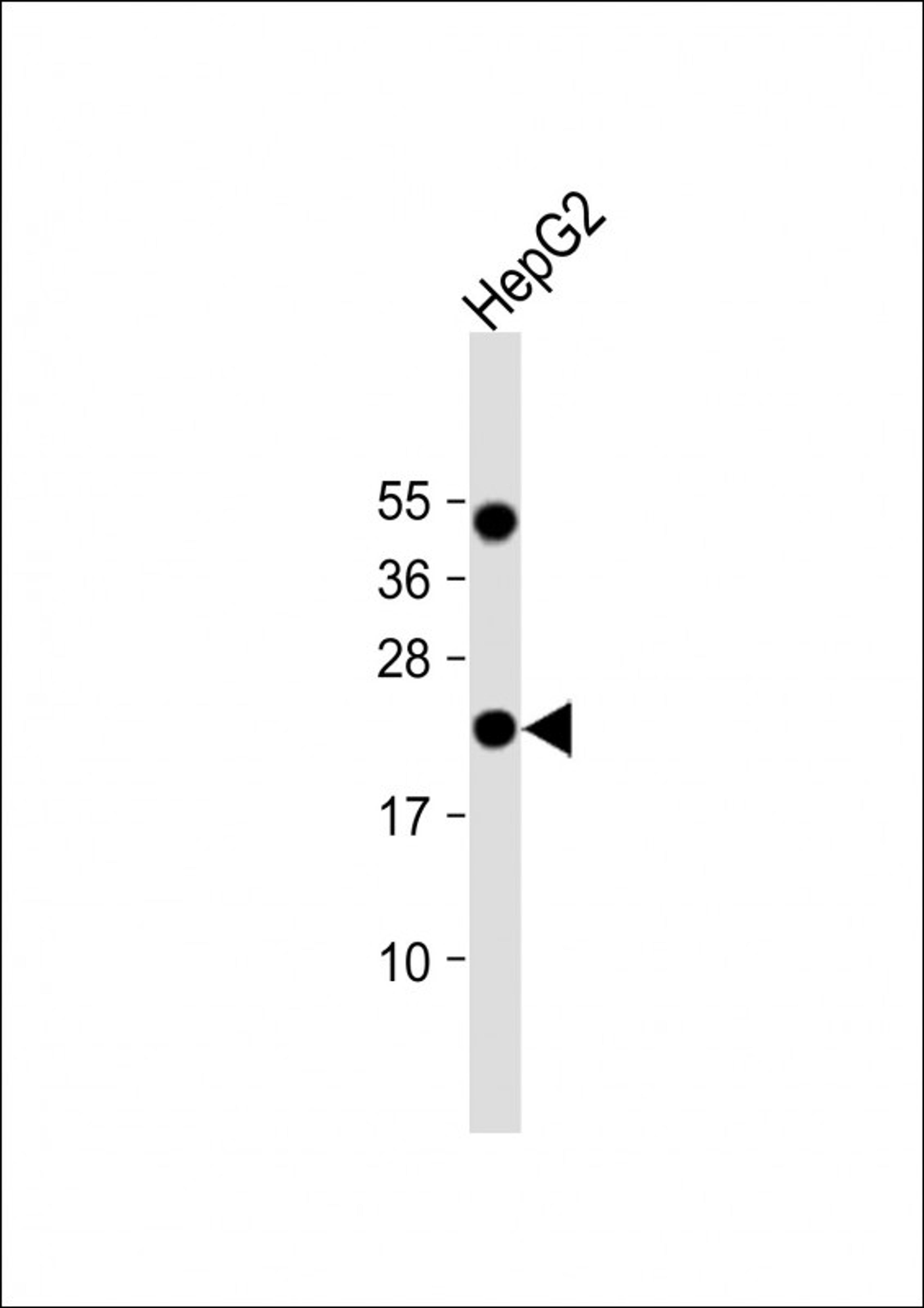 Western Blot at 1:1000 dilution + HepG2 whole cell lysate Lysates/proteins at 20 ug per lane.