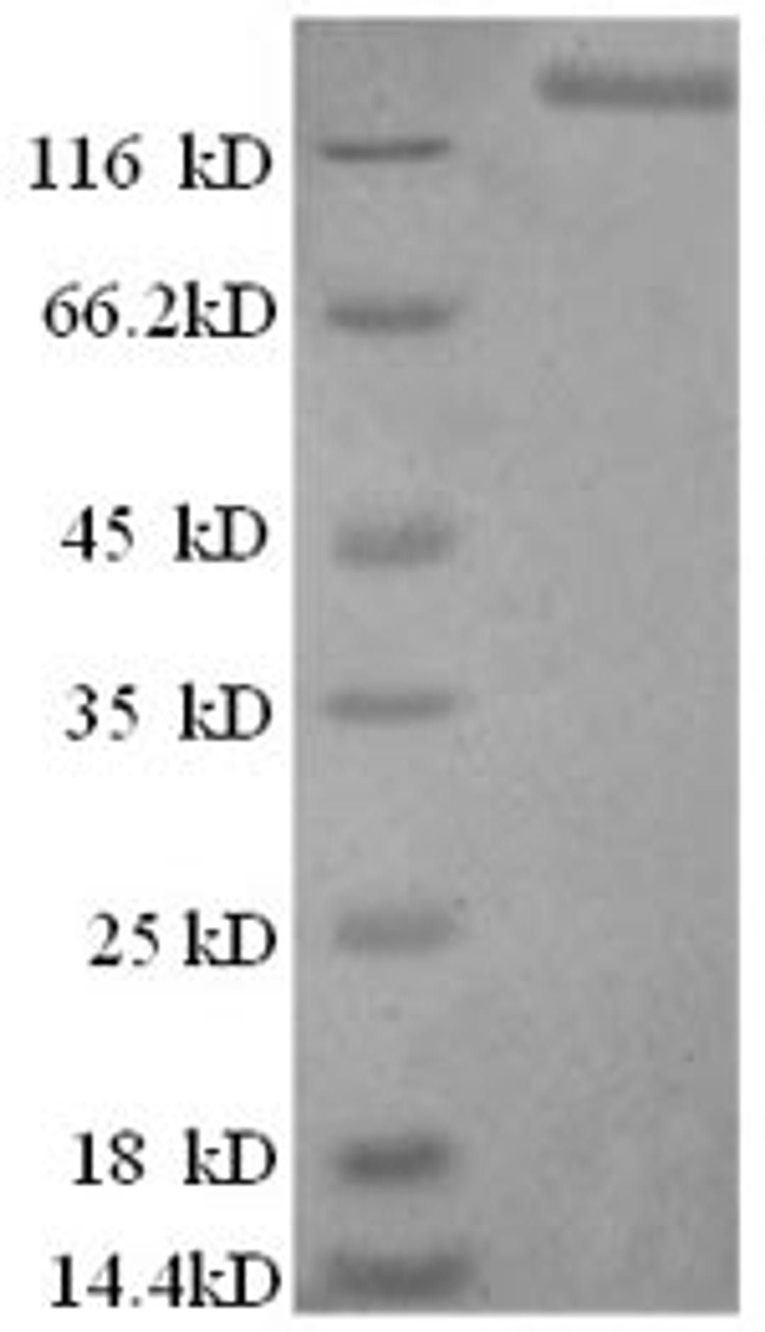 (Tris-Glycine gel) Discontinuous SDS-PAGE (reduced) with 5% enrichment gel and 15% separation gel.
