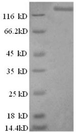 (Tris-Glycine gel) Discontinuous SDS-PAGE (reduced) with 5% enrichment gel and 15% separation gel.