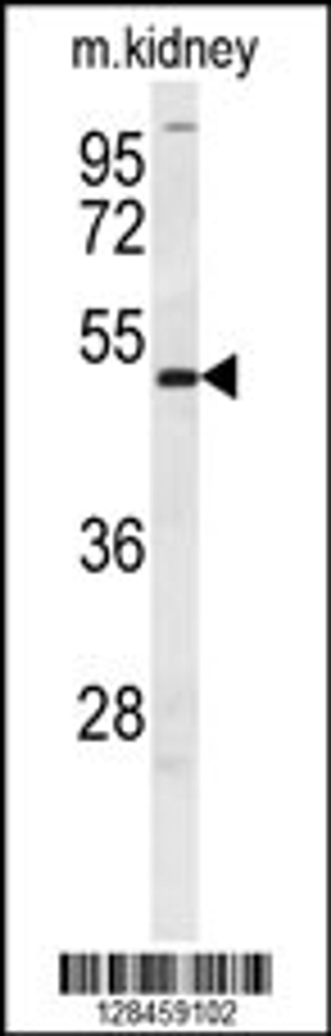 Western blot analysis in mouse kidney tissue lysates (35ug/lane).