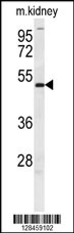 Western blot analysis in mouse kidney tissue lysates (35ug/lane).