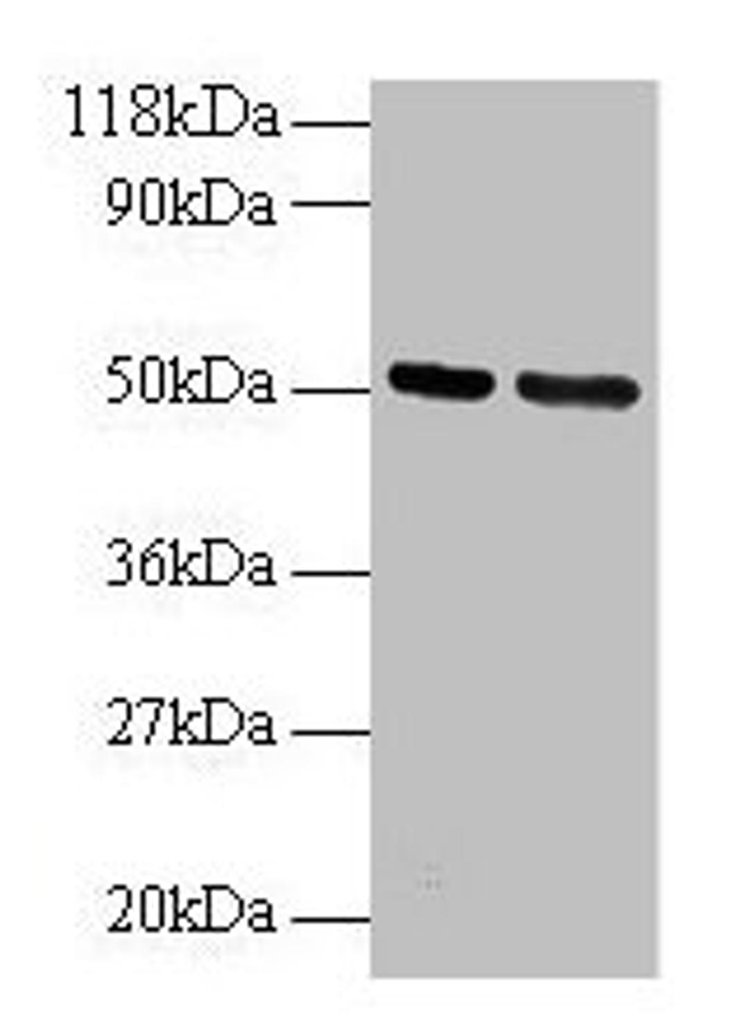 Western blot. All lanes: GDI2 antibody at 2µg/ml. Lane 1: 293T whole cell lysate. Lane 2: EC109 whole cell lysate. Secondary. Goat polyclonal to rabbit IgG at 1/15000 dilution. Predicted band size: 51, 46 kDa. Observed band size: 51 kDa