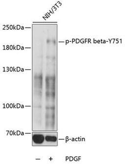 Western blot - Phospho-PDGFR beta-Y751 antibody (AP0493)