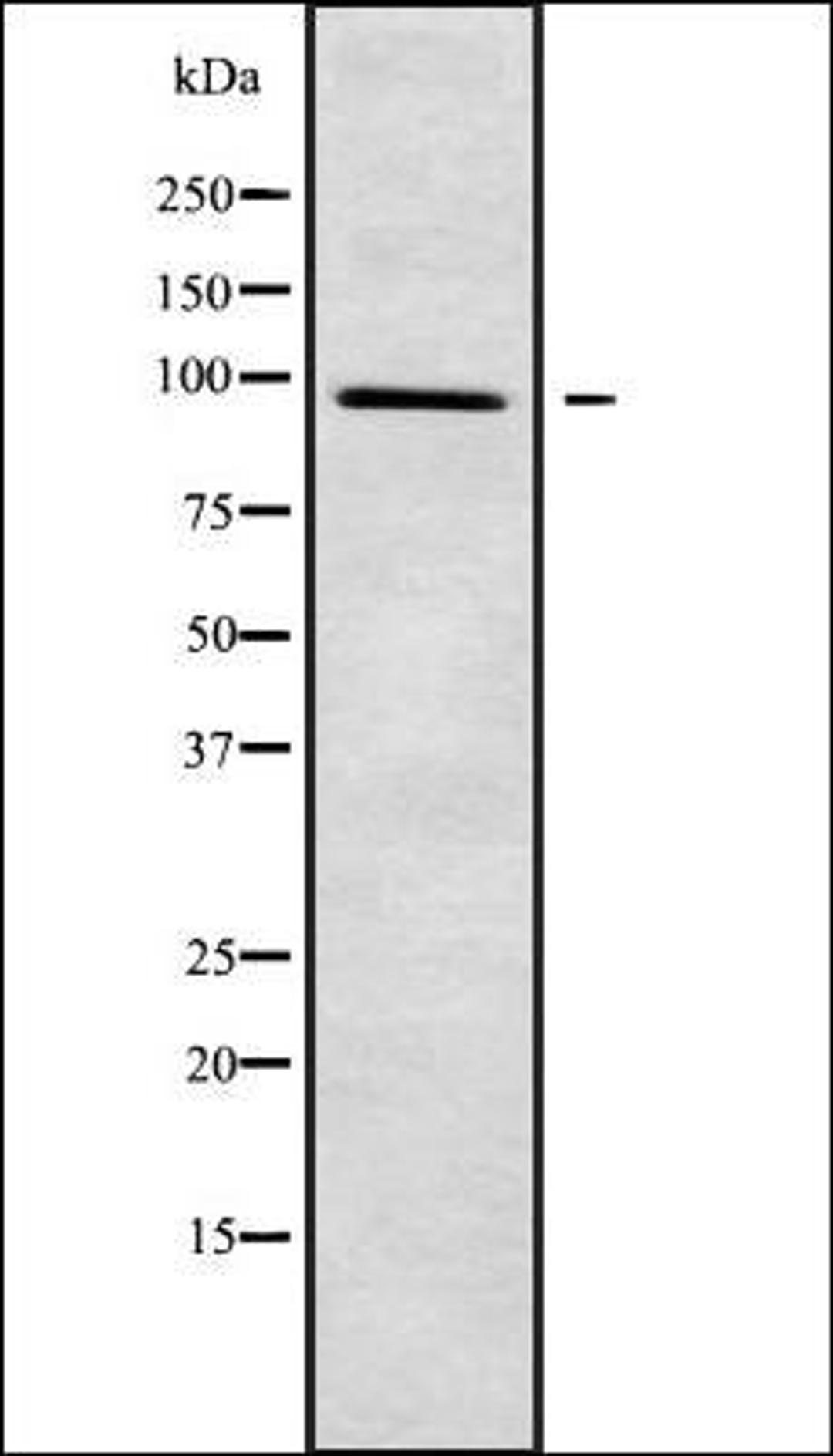 Western blot analysis of 293 whole cell lysates using PLA2G4F antibody