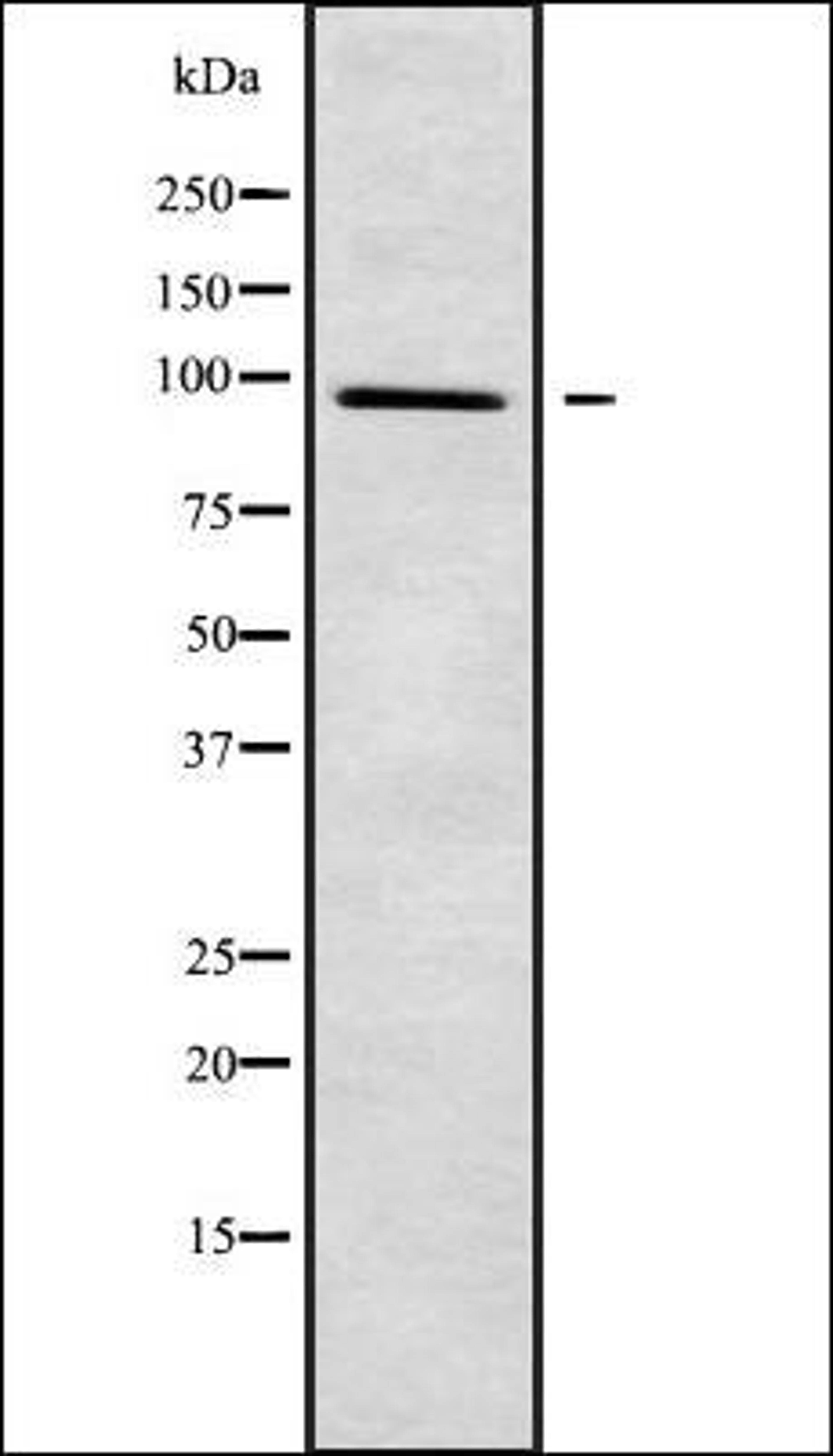 Western blot analysis of 293 whole cell lysates using PLA2G4F antibody