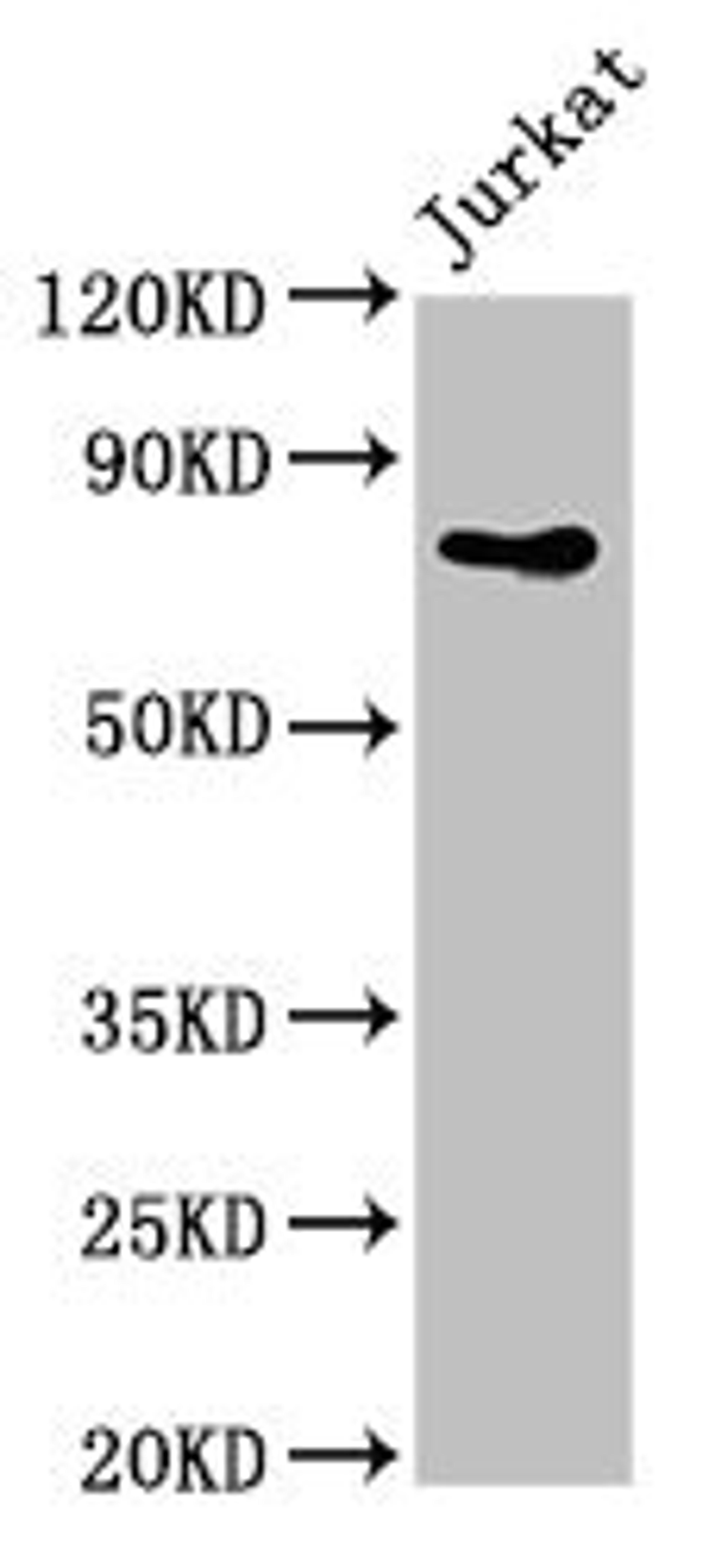 Western Blot. Positive WB detected in: Jurkat whole cell lysate. All lanes: PIK3R2 antibody at 4ug/ml. Secondary. Goat polyclonal to rabbit IgG at 1/50000 dilution. Predicted band size: 82 kDa. Observed band size: 82 kDa. 