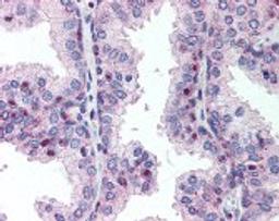 Immunohistochemistry staining of MLF1IP in prostate tissue using MLF1IP Antibody.