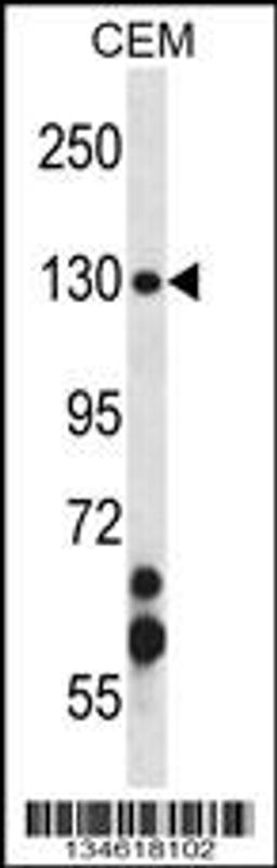 Western blot analysis in CEM cell line lysates (35ug/lane).