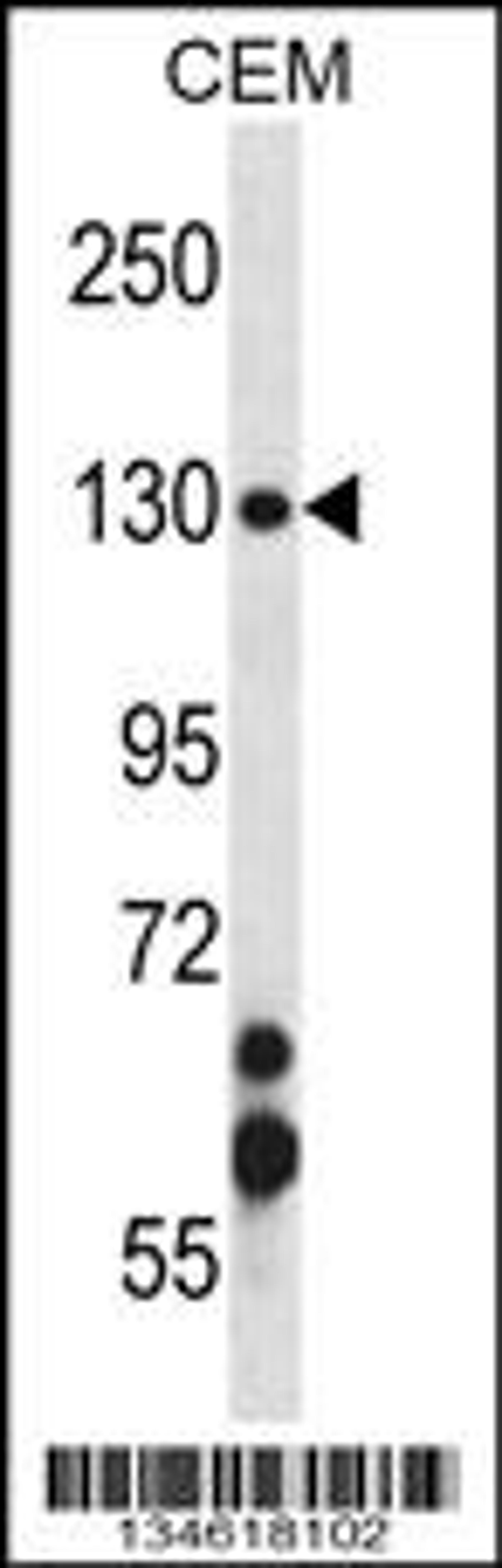 Western blot analysis in CEM cell line lysates (35ug/lane).