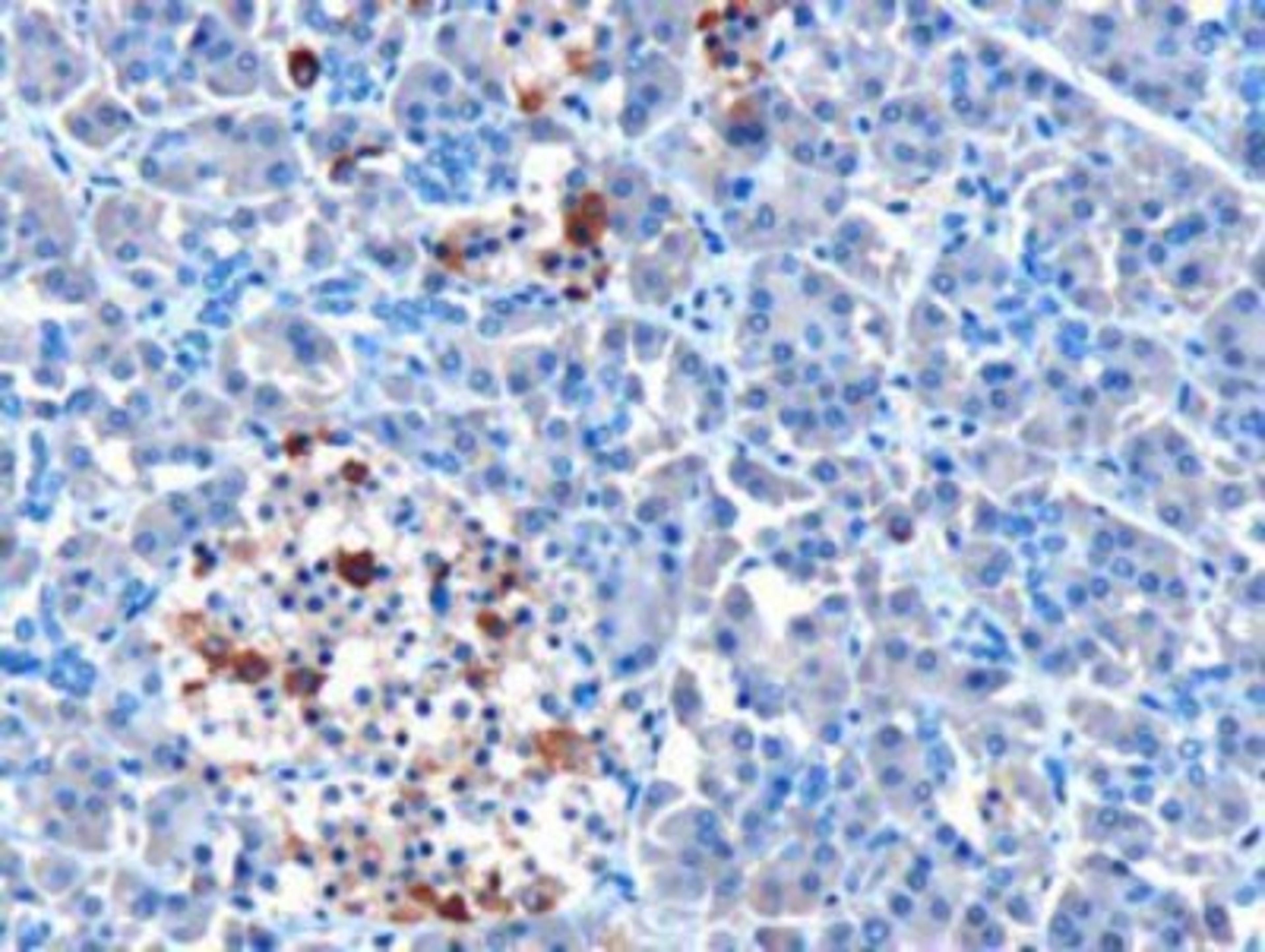 Immunohistochemistry-Paraffin: MDA5 Antibody [NB110-1244] - IHC analysis of MDA5 staining in paraffin embedded Human Pancreas using (10ug/ml). Microwaved antigen retrieval with Tris/EDTA buffer pH9, HRP-staining.