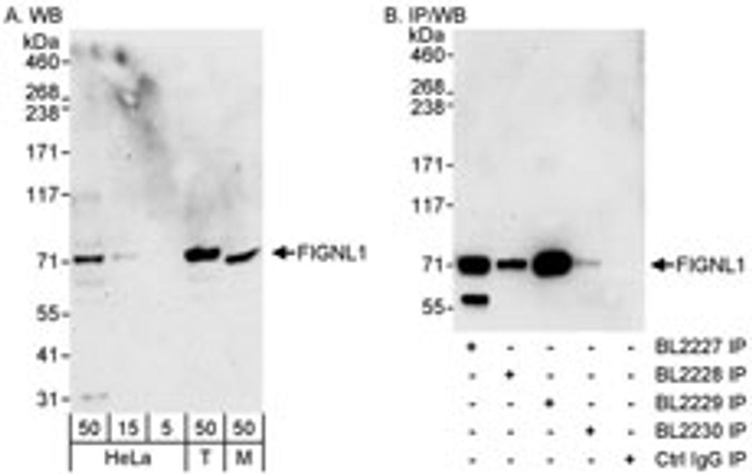 Detection of human and mouse FIGNL1 by western blot (h&m) and immunoprecipitation (h).